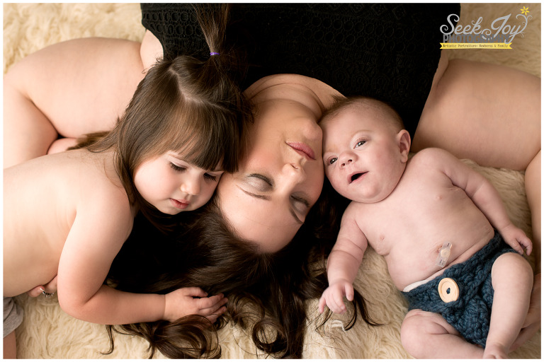 special needs baby photography